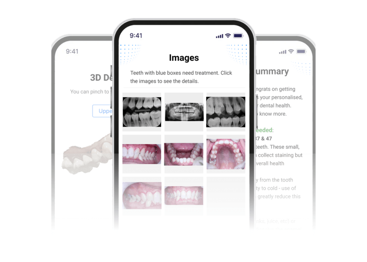 Smart X-ray